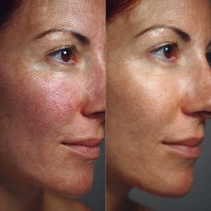 Aesthetics before and after photo